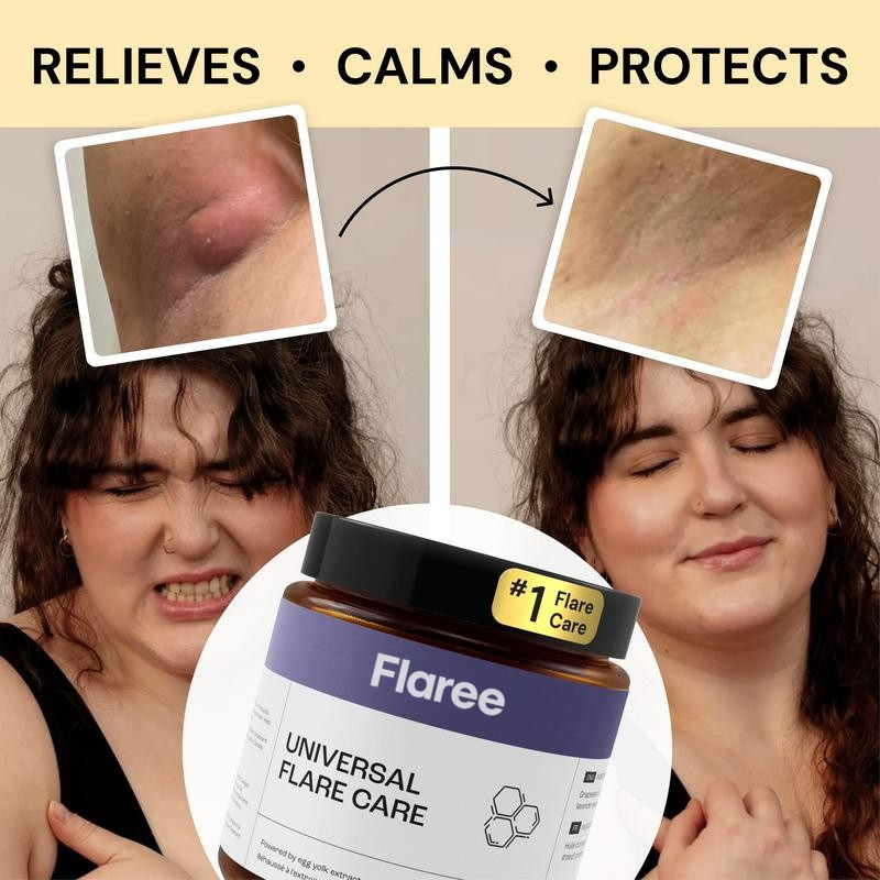 Magic Flare Care