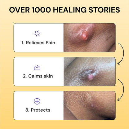 Magic Flare Care